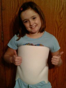 Helping girls with Scoliosis - Ortho Illinois